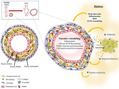 Protection of diabetes in aortic abdominal aneurysm: Are antidiabetics the real effectors?